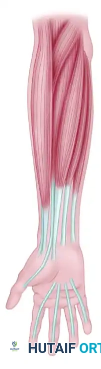 RESTORATION OF PINCH Surgical Diagram