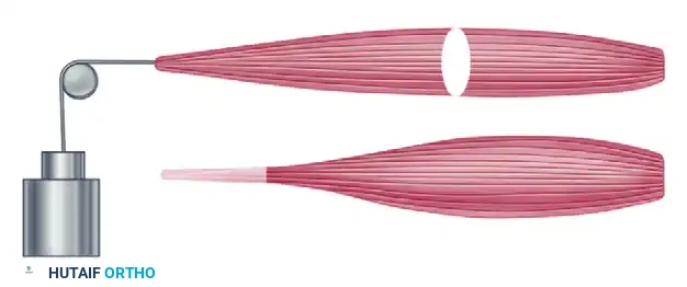 RESTORATION OF PINCH Surgical Diagram