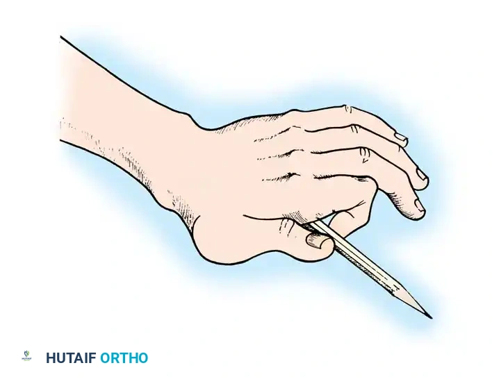 Fig. 68-4 Pattern of substitution for opposition (see text).