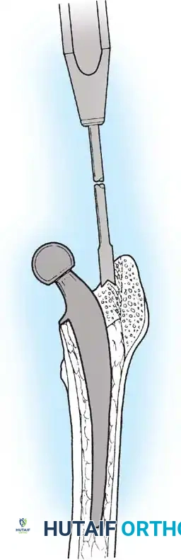 Hutaifortho's Orthopaedic Diagram