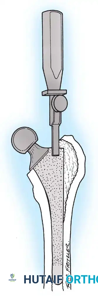 Hutaifortho's Orthopaedic Diagram