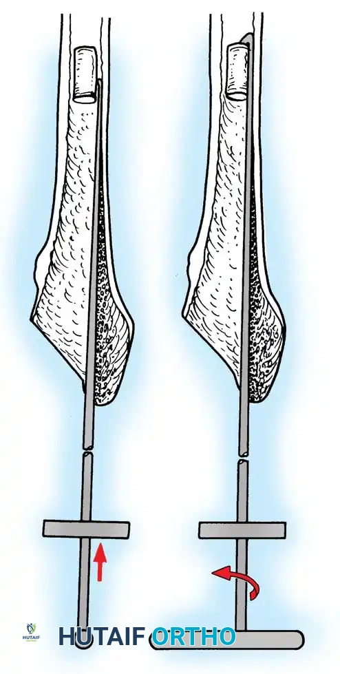 Hutaifortho's Orthopaedic Diagram