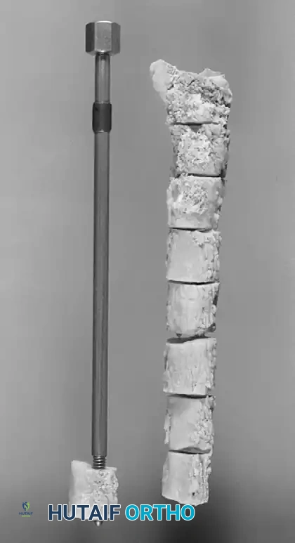 Hutaifortho's Orthopaedic Diagram