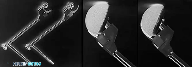 Hutaifortho's Orthopaedic Diagram