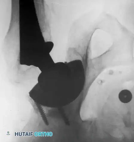 Hutaifortho's Orthopaedic Diagram