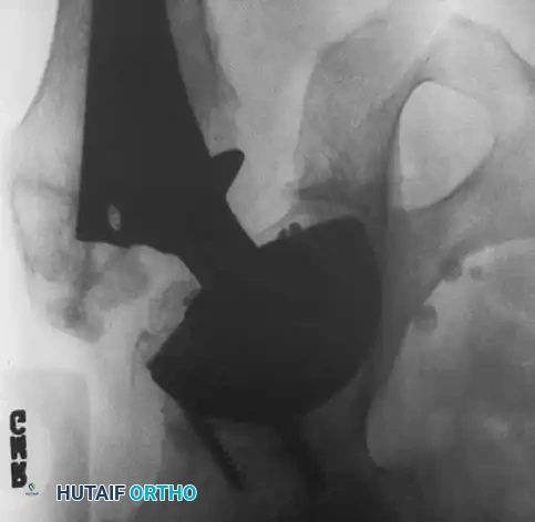 Hutaifortho's Orthopaedic Diagram