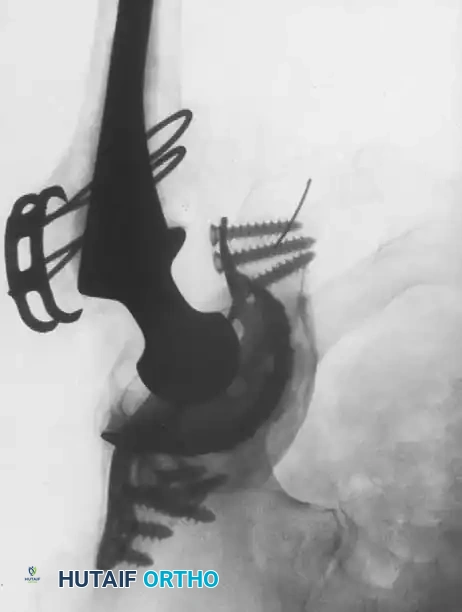 Hutaifortho's Orthopaedic Diagram