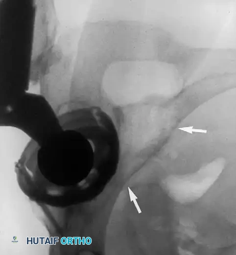 Hutaifortho's Orthopaedic Diagram