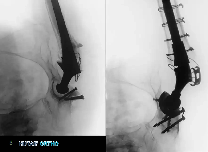 Hutaifortho's Orthopaedic Diagram