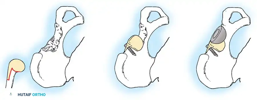 Hutaifortho's Orthopaedic Diagram