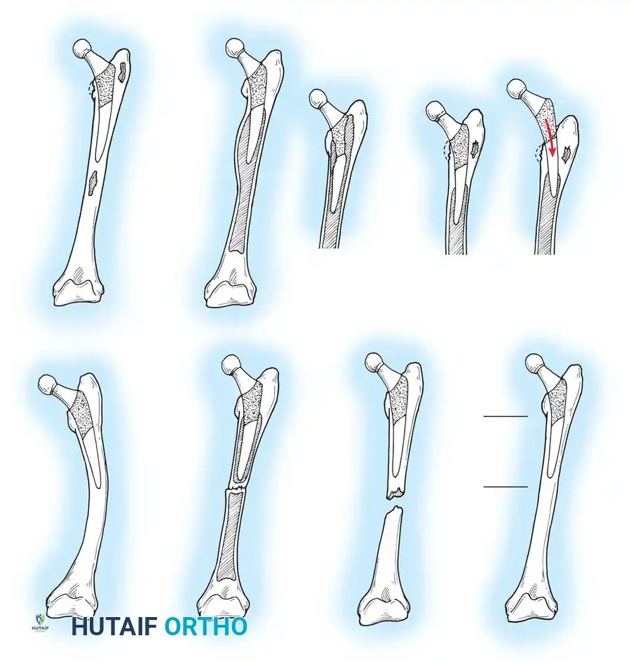 Hutaifortho's Orthopaedic Diagram