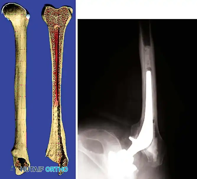 Hutaifortho's Orthopaedic Diagram