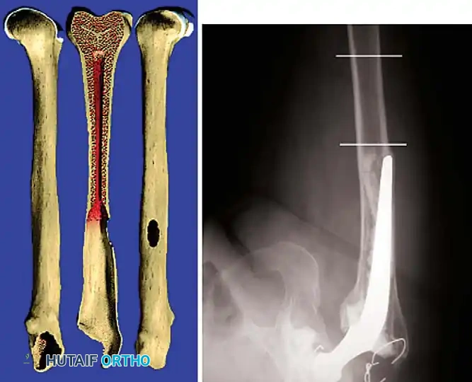Hutaifortho's Orthopaedic Diagram