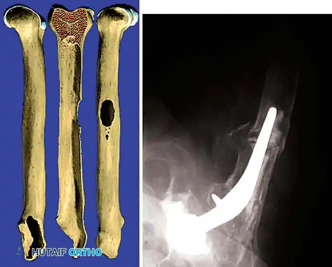 Hutaifortho's Orthopaedic Diagram