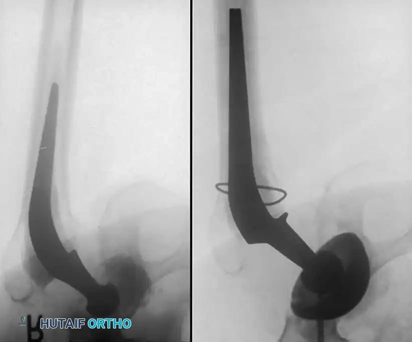 Hutaifortho's Orthopaedic Diagram