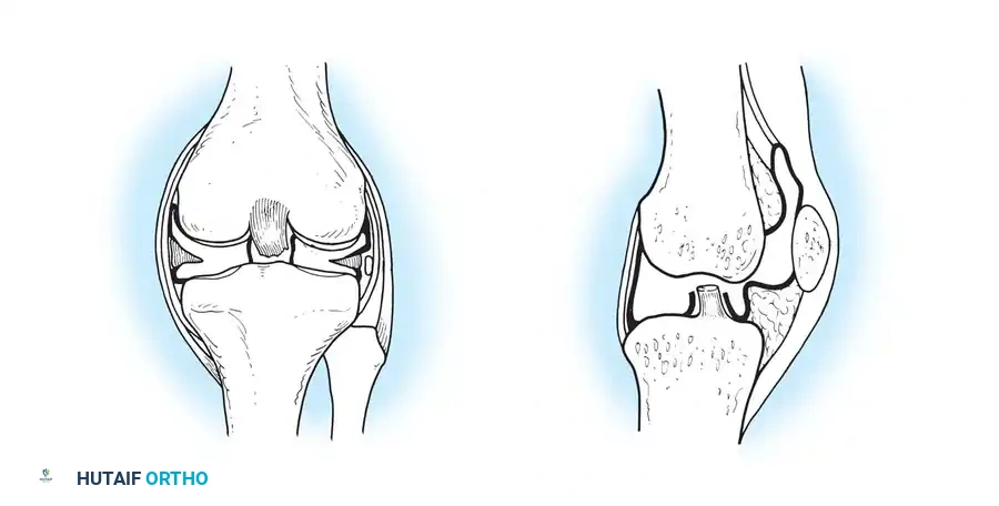 الدليل الشامل لمرض التهاب المفاصل الروماتويدي