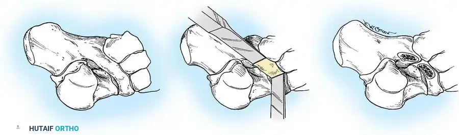 Hutaifortho's Orthopaedic Diagram