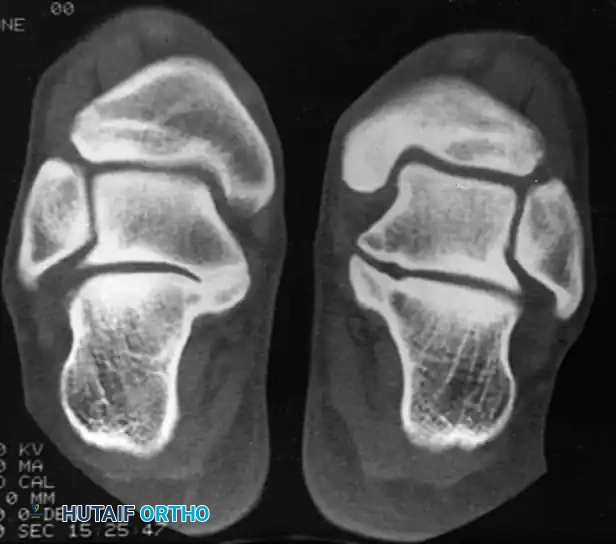 Hutaifortho's Orthopaedic Diagram
