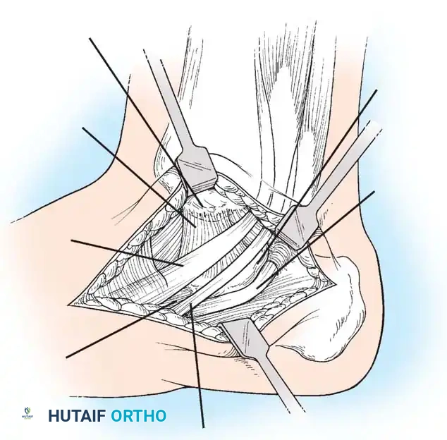 Hutaifortho's Orthopaedic Diagram