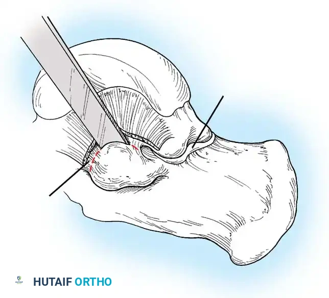 Hutaifortho's Orthopaedic Diagram