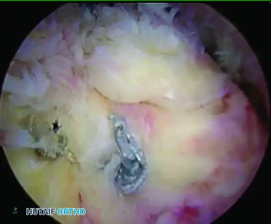 Hutaifortho's Orthopaedic Diagram