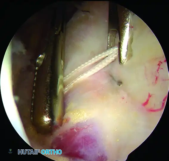 Hutaifortho's Orthopaedic Diagram