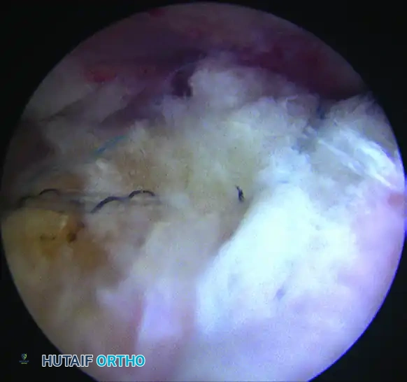 Hutaifortho's Orthopaedic Diagram