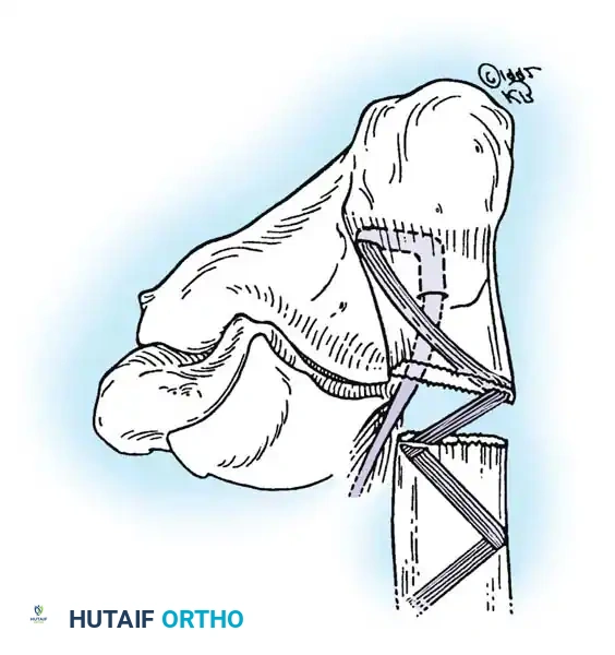 Hutaifortho's Orthopaedic Diagram