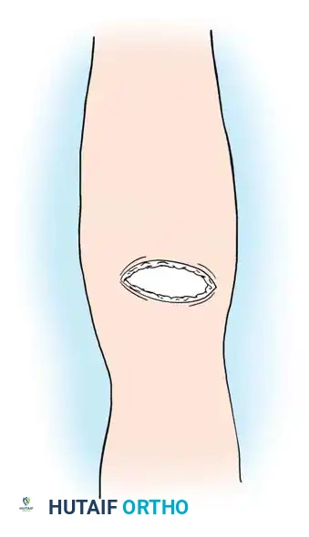 Hutaifortho's Orthopaedic Diagram