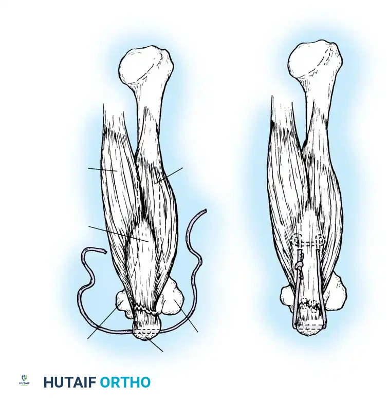 Hutaifortho's Orthopaedic Diagram
