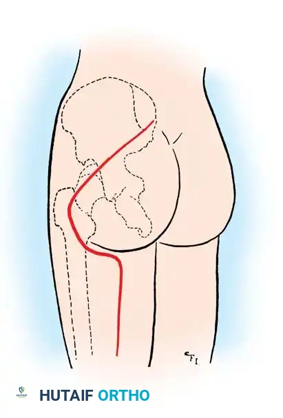 Surgical anatomy of sciatic nerve and related structures in buttock
