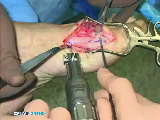 تقييم الأعراض السريرية