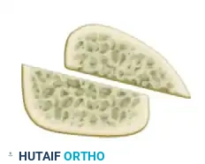 تقييم كثافة العظام قبل الجراحة