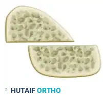 تطور القدرة على المشي وتحمل الوزن