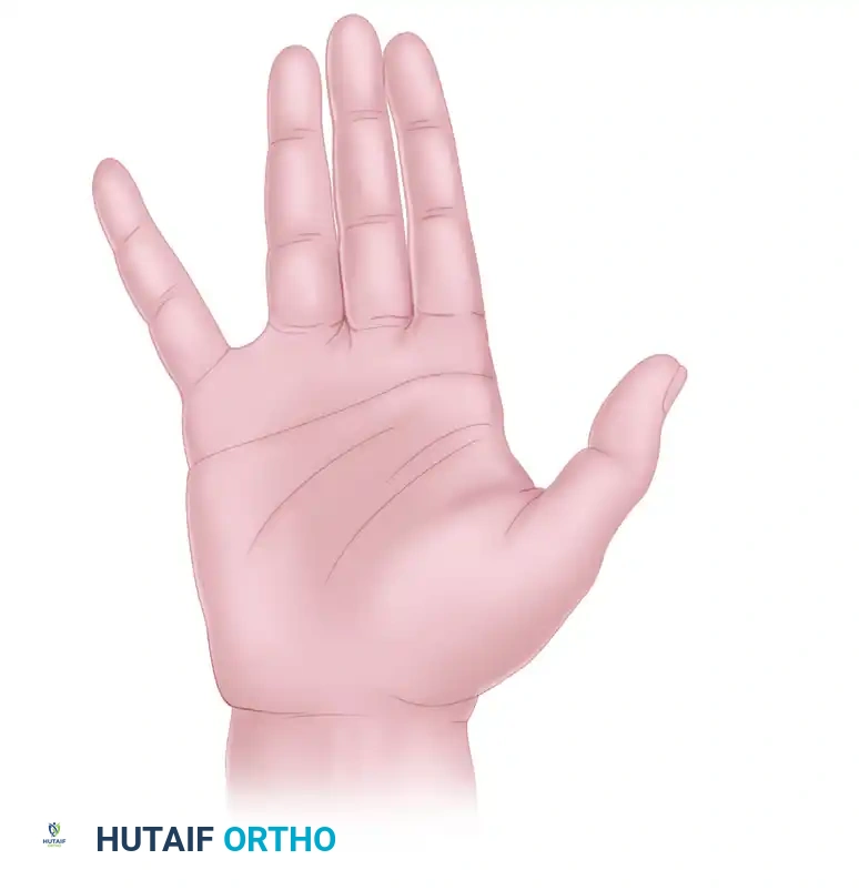 Peripheral Nerve Injury: Classification & Clinical Evaluation