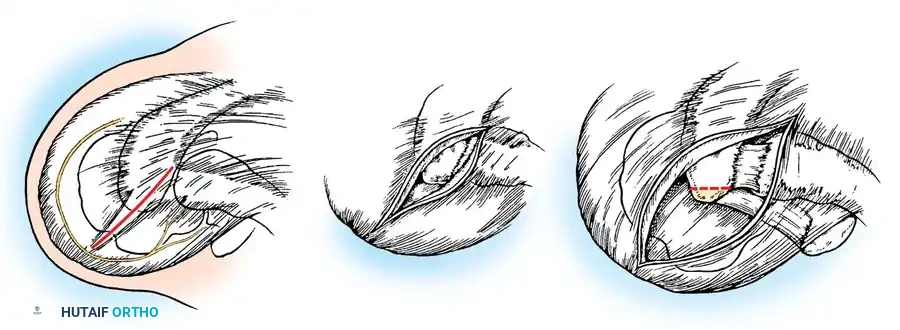 Hutaifortho's Orthopaedic Diagram