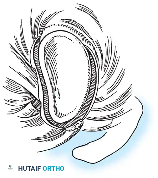 Hutaifortho's Orthopaedic Diagram
