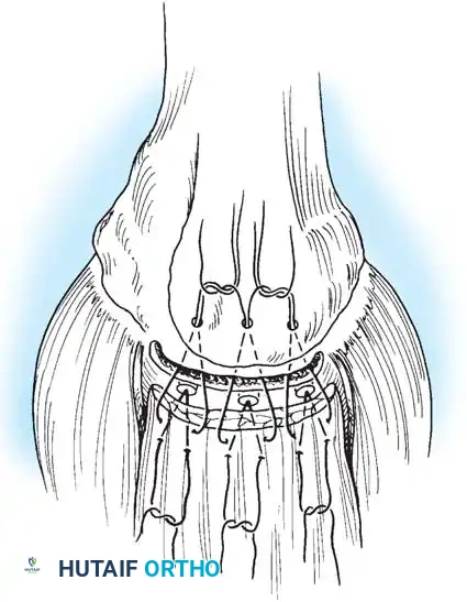 Hutaifortho's Orthopaedic Diagram