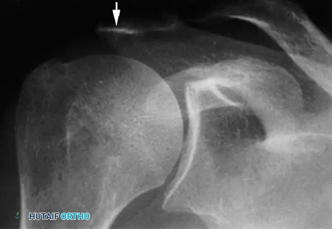 Hutaifortho's Orthopaedic Diagram