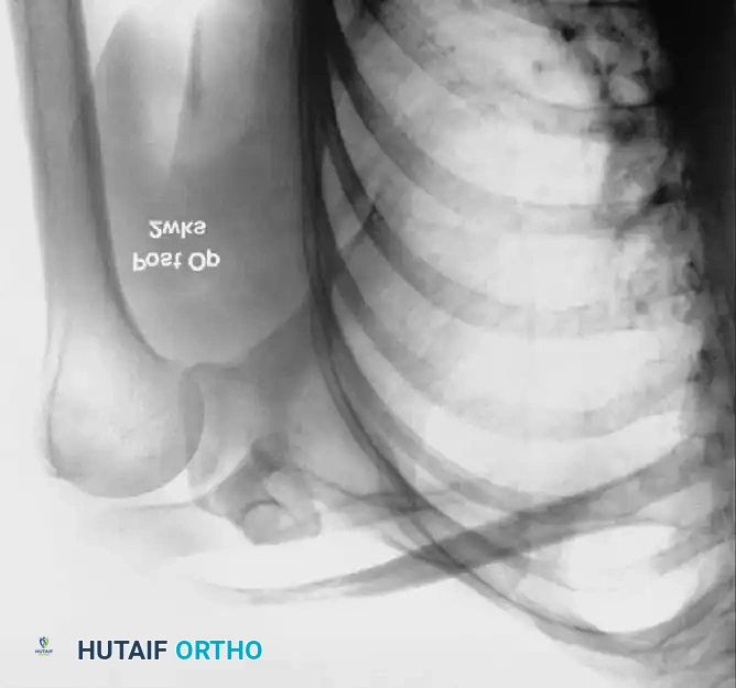 Hutaifortho's Orthopaedic Diagram