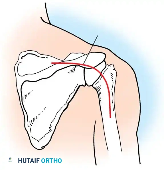 Hutaifortho's Orthopaedic Diagram
