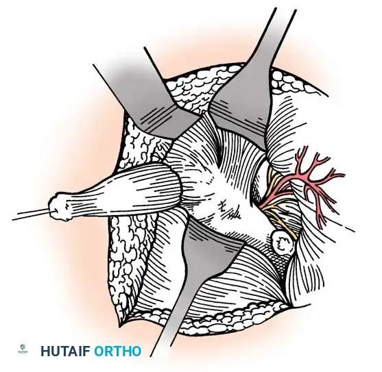 Hutaifortho's Orthopaedic Diagram