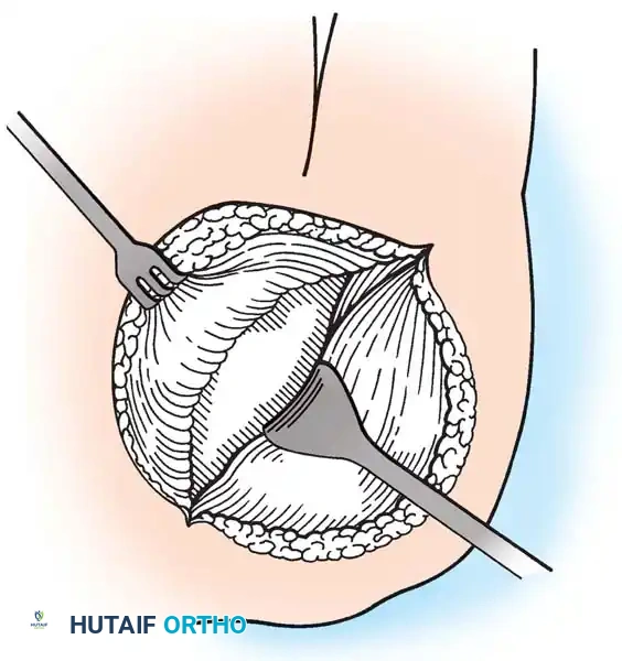 Hutaifortho's Orthopaedic Diagram