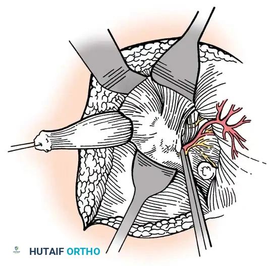 Hutaifortho's Orthopaedic Diagram