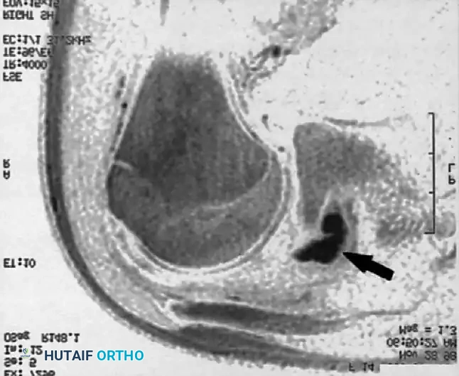 Hutaifortho's Orthopaedic Diagram