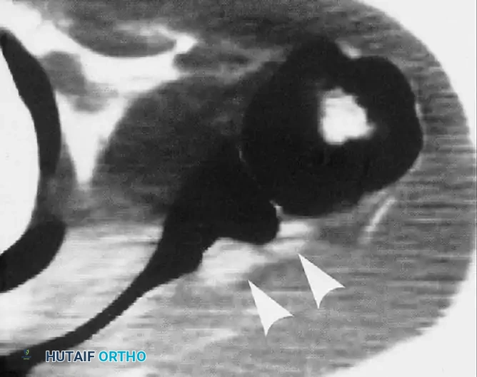Hutaifortho's Orthopaedic Diagram