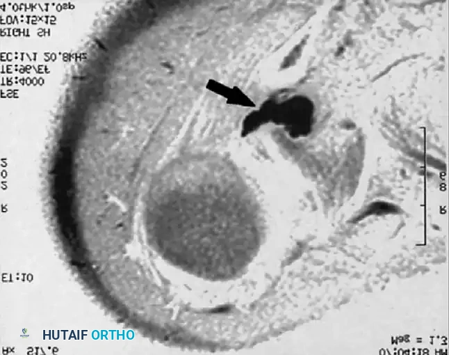 Hutaifortho's Orthopaedic Diagram