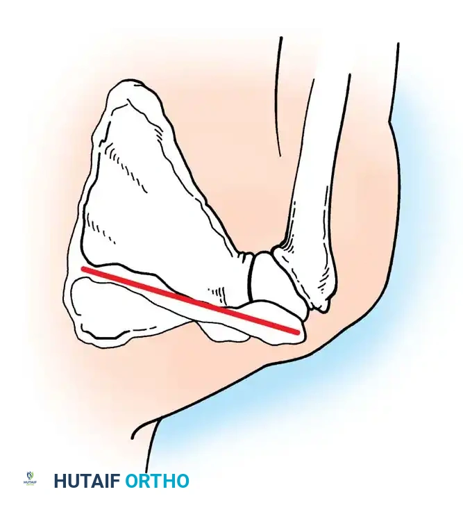 Hutaifortho's Orthopaedic Diagram