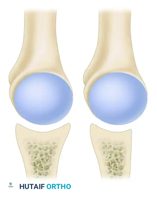 Master Shoulder Tests: Know the Author & Year for Each Technique
