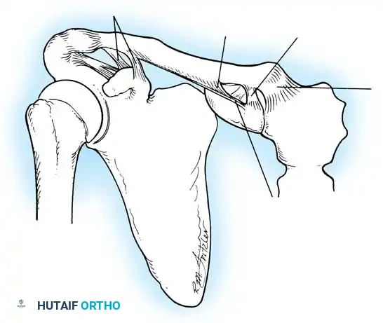 Coracoclavicular ligaments Subclavius muscle Costoclavicular ligament